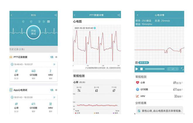 智能手环能测血压心电？dido Y1高精度测血压手环孝敬父母没商量(图9)